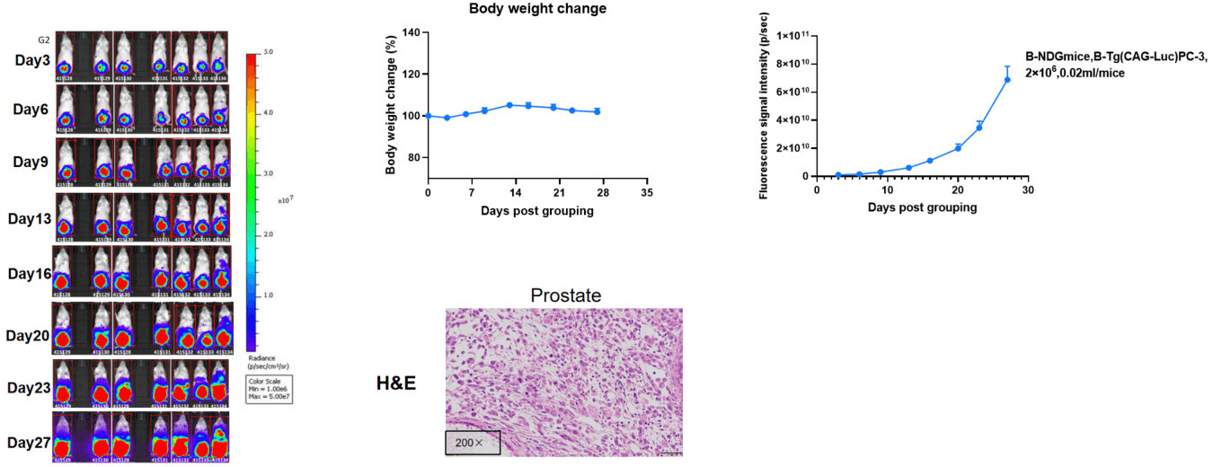 B-Tg(Luc) PC-3 in B-NDG Mice