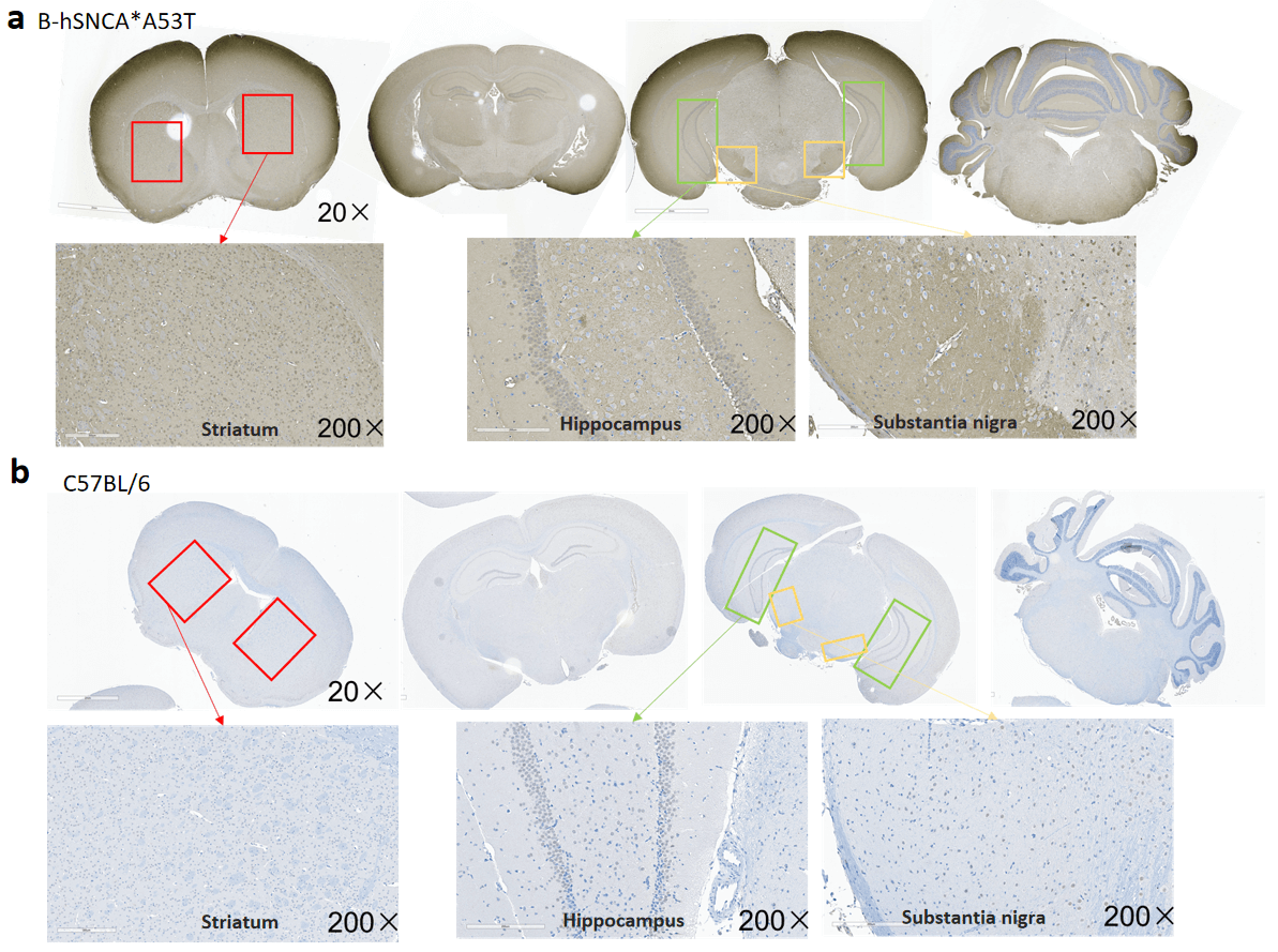 Expression of human a-synuclein (haSyn) in B-hSNCA*A53T