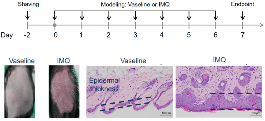 Establishment of Psoriasis Mouse Model