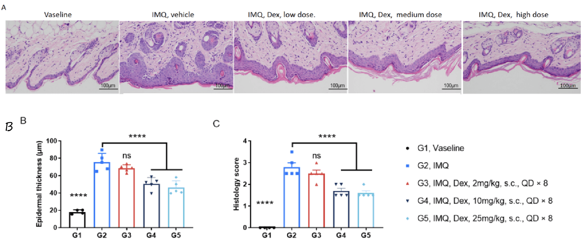 In Vivo Efficacy of Dexamethasone in a Psoriasis Model of C57BL/6 Mice 2