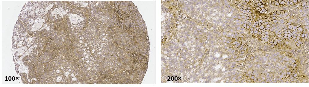 EGFR in BP0508