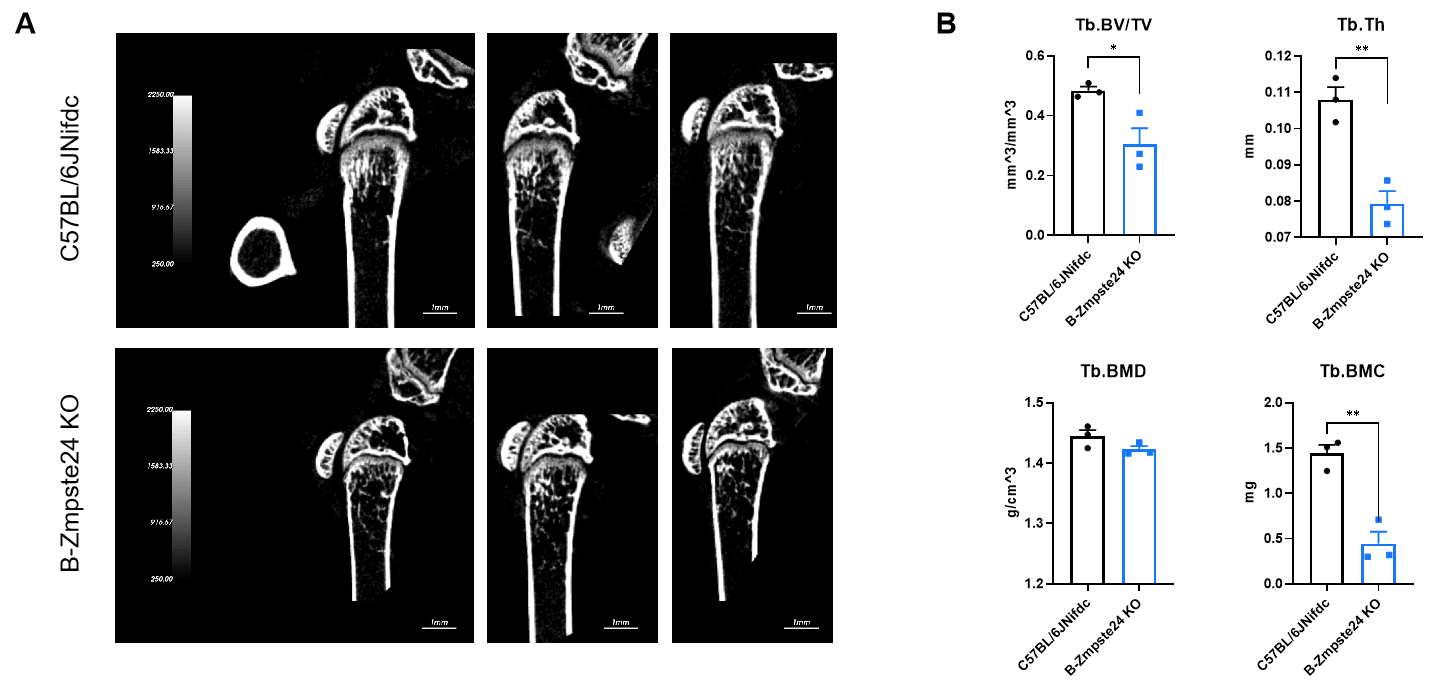 Micro-CT analysis of bone microarchitecture in B-Zmpste24 KO mice