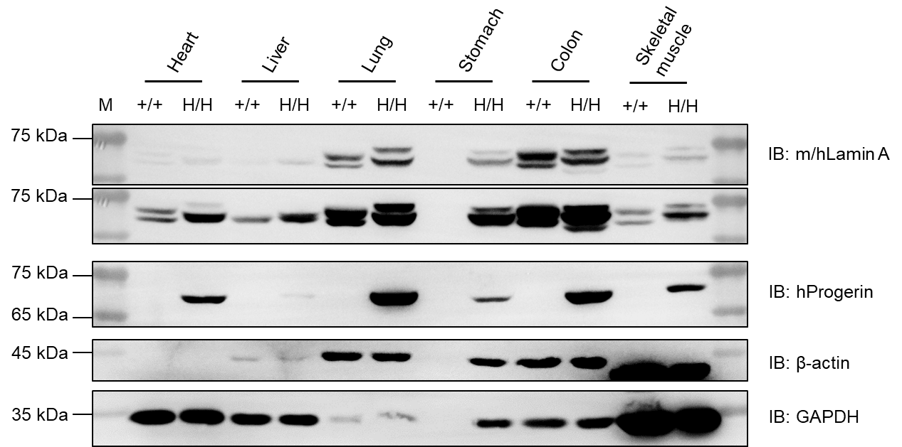 Validation of LMNA*G608G Expression in B-hLMNA*G608G KO Mice 2