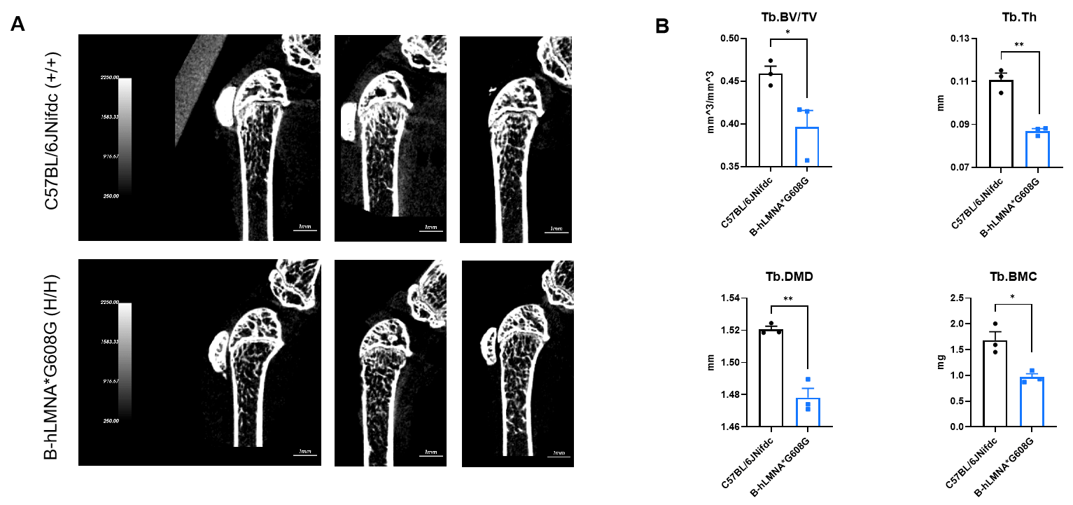 Micro-CT analysis of bone microarchitecture in B-hLMNA*G608G mice