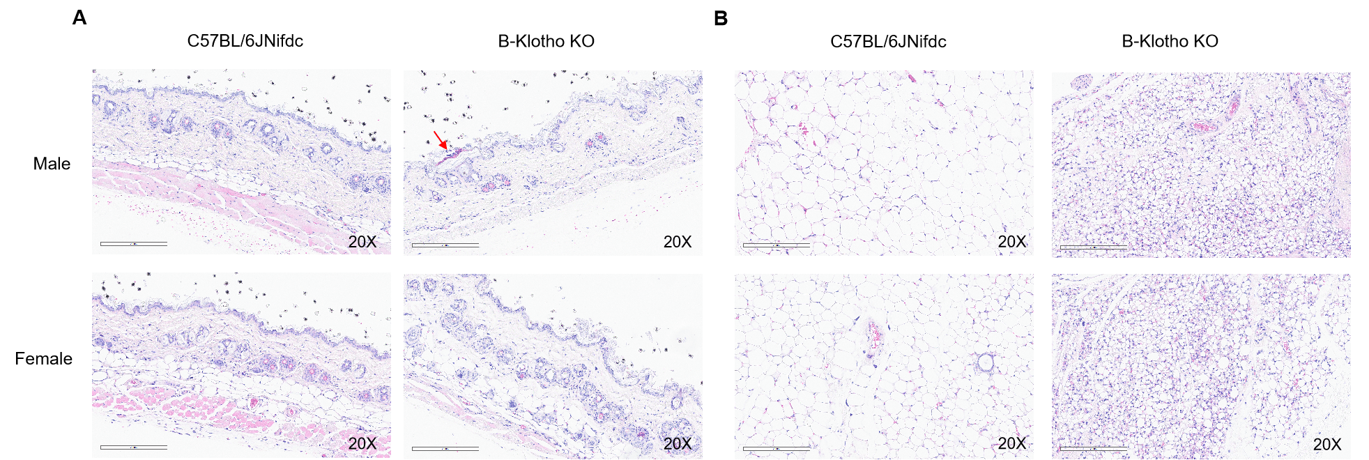 Histopathological analysis of adipocyte atrophy in B-Klotho KO mice